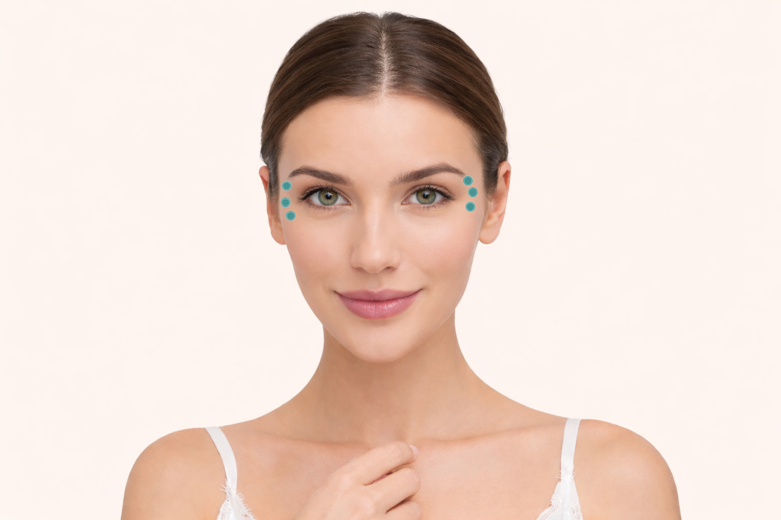 Botox behandeling - Kraaienpootjes